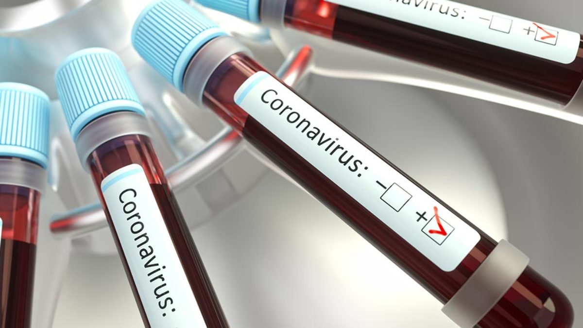 Coronavirus In Koln Alle Aktuellen Infos Im Live Ticker Stand 21 03 2021